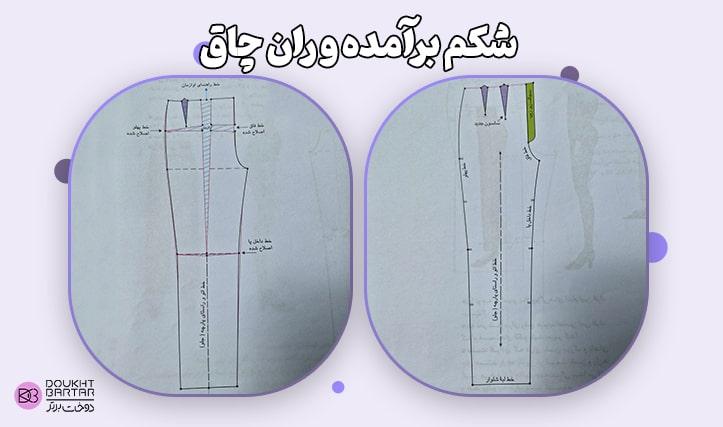شکم برآمده و ران چاق