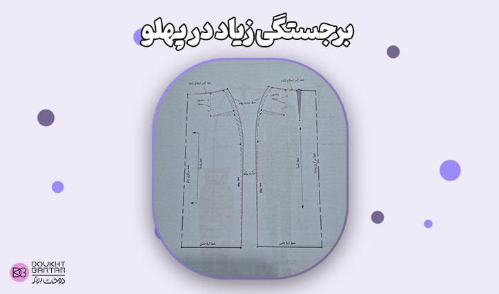 برجستگی زیاد در پهلو