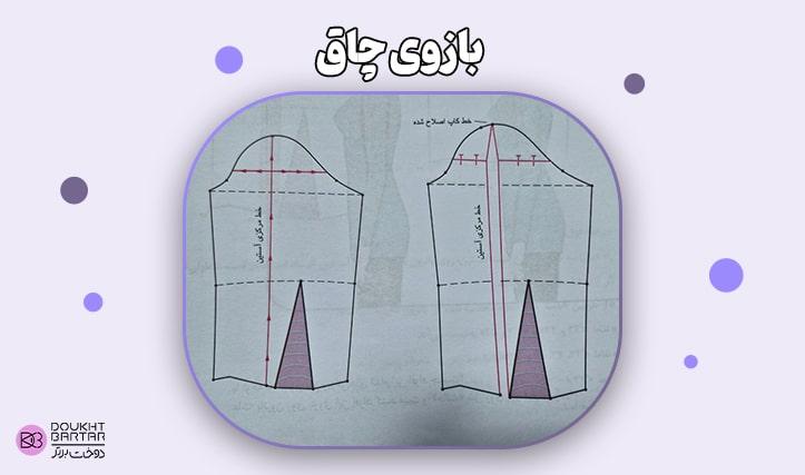 بازوی چاق